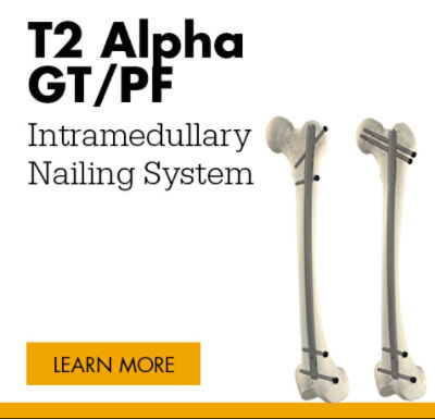 T2 Alpha GT PF