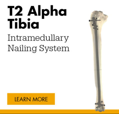 T2 Alpha Tibia