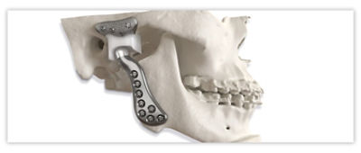 Pediatric Mandibular Distractor product