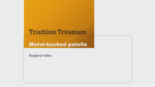 Triathlon Cementless metal-backed patella surgery
