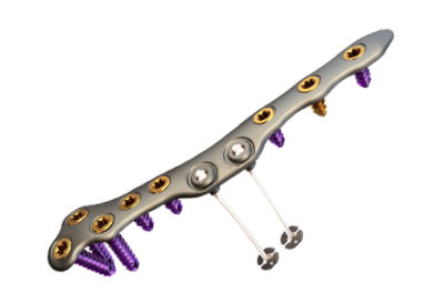 Thumb-GravitySynchfix