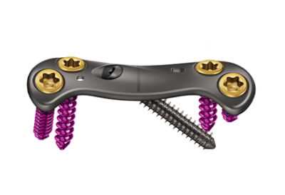 Thumb-OrtholocCrrosscheck