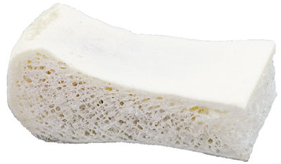 Bio Wedge
