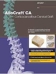 AlloCraft CA Brochure