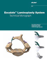 Escalate Technical Monograph