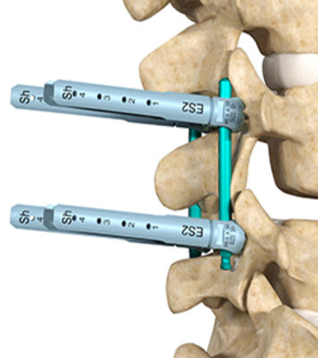 ES2 product image