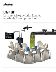 LITe LIF Brochure