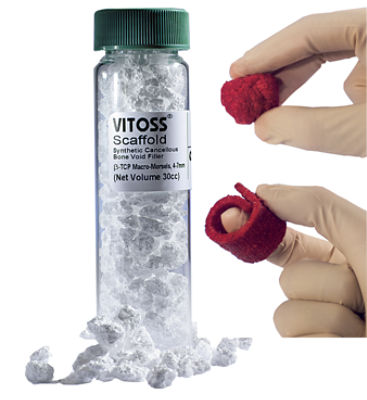 Vitoss