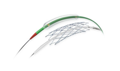 Wingspan Stent System