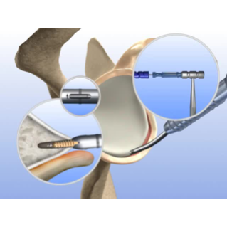 TwinLoop FLEX overview