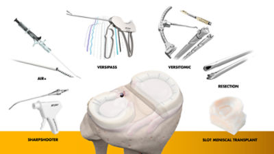 Meniscal repair