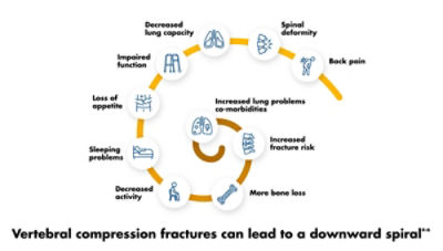 Left untreated, patients can face long-term complications known as the “downward spiral”