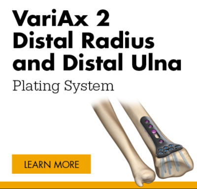 VariAx 2 Distal Radius