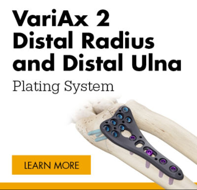 VariAx 2 Distal Radius
