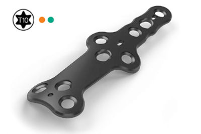 Medial Column Fusion (NCM)