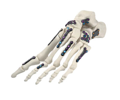 Variax 2 foot Product image