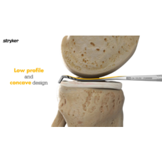 Versitomic RR Meniscal Root Repair Animation (8).mp4