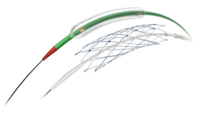 Wingspan Stent System and Gateway PTA Balloon Catheter