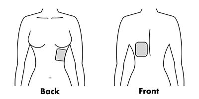 Anterior-posterior placement of AED pads