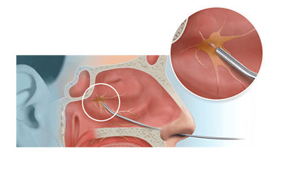 anesthesia-needle-anatomy