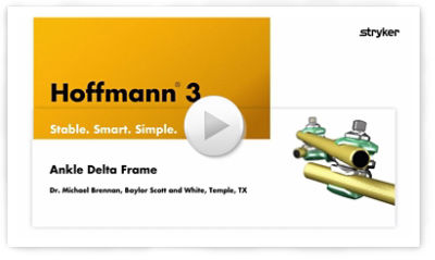 Ankle Delta Frame sawbone demonstration