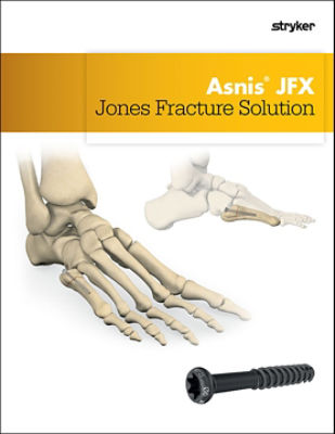 Asnis JFX features and benefits