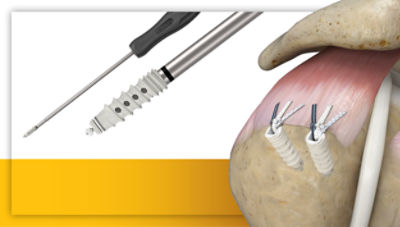 AlphaVent Biocomposite product