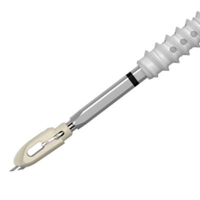 AlphaVent Knotless coupled, self-punching anchor system