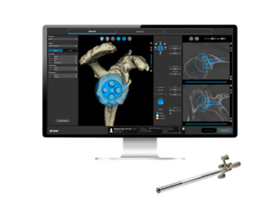 Leading orthopedic teams trust Blueprint with over 250k case plans globally