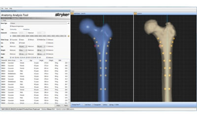 bone-screen-image