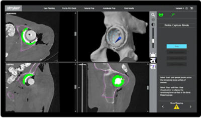 bone mapping