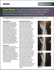 VariAx 2 Distal Radius Case Study