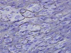 Collagen stain