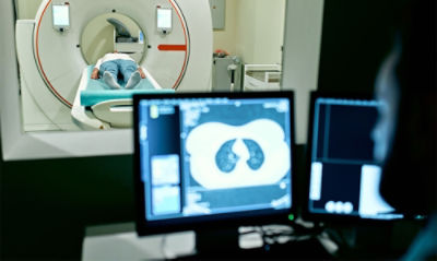 ct scan stock photo