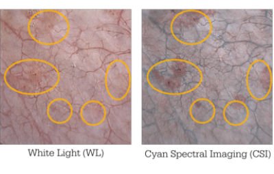 cyan-spectral-imaging