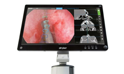 dependable tracking screen on XprESS ENT dilation system
