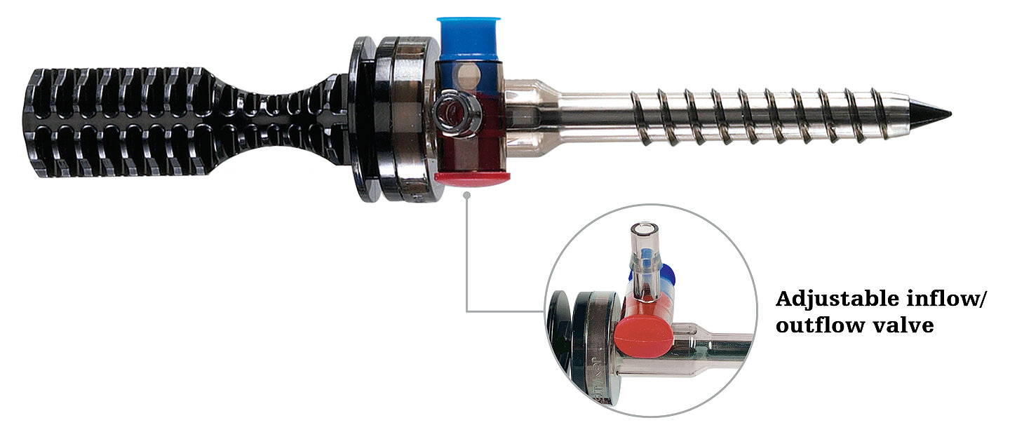 Dri-Lok adjustable inflow-outflow valve