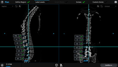 Mako Spine | Stryker