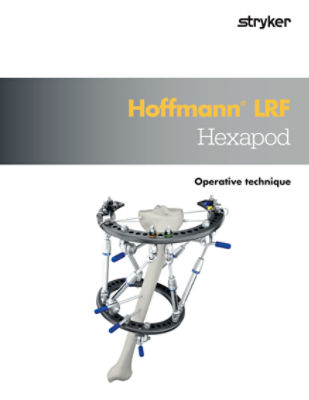 Hoffmann LRF Hexapod Operative Technique