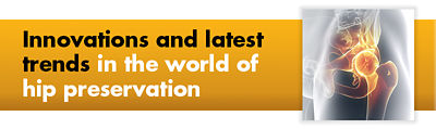 Card with text: Innovations and latest trends in the world of hip preservation