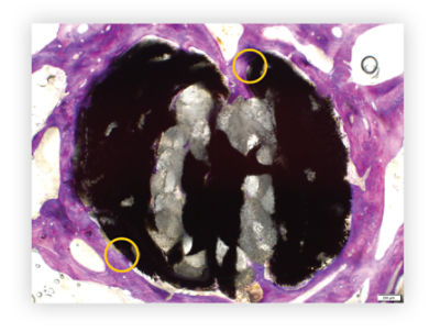 histology-comparisons_12-wks-iconix-ha-plus