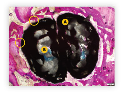 histology-comparisons_4-wks-iconix-ha-plus