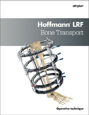 Hoffmann LRF Bone Transport Operative Technique
