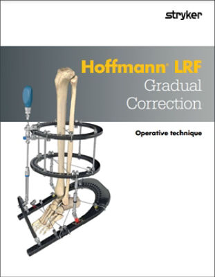 Hoffmann LRF Gradual Correction Operative Technique