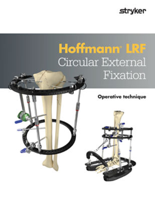 Hoffmann LRF operative technique