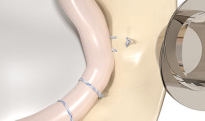 instability-CTA-thumb