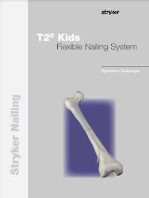 T2 Kids Flexible Nailing operative technique