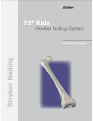 T2 Kids Flexible Nailing operative technique