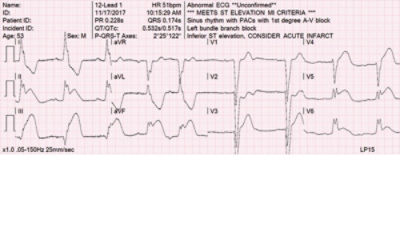 ECG read out display 