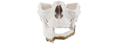 mandible-reconstruction